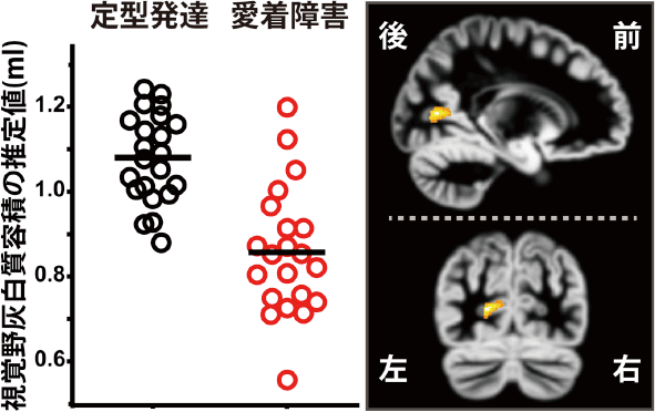 }3<br>
VBM@ɂ锽A^b`gQiRADjQ̔]玿eό