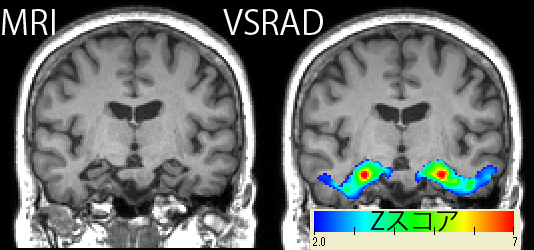 AcnC}[ałVSRADadvance