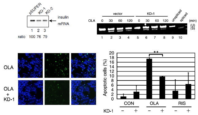 }PQ. Insulin mRNA ̃mbN_EolanzapineɂA|g[VX}