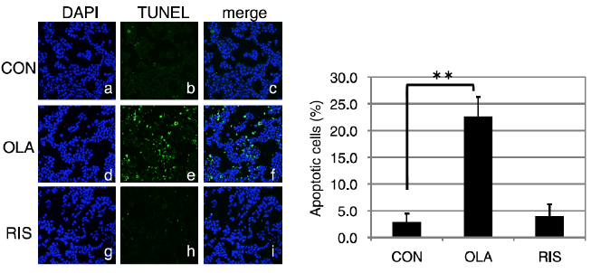 }T.olanzapine HIT-T15 cells̃A|g[VXU