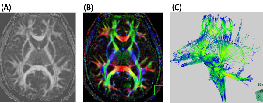 }2@FA map(A)Acolor map(B)AgUe\gNgOtB(C)